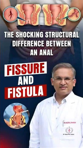Do You Know The Real Difference Between Fissure and Fistula? Explained | Dr. Neeraj Dhamija