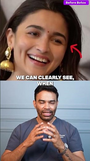 This is what happens when Botox is done right.