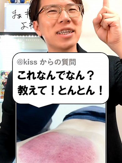 吸い玉についての疑問とその理由