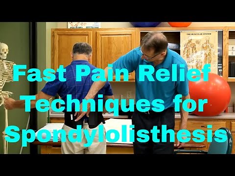 Fast Pain Relief Techniques for Spondylolisthes (Real Patient Treatments & Exercise)