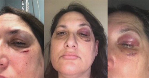 Nurse reveals brutal attack in the ER as Maryland healthcare workers increasingly face violence on t