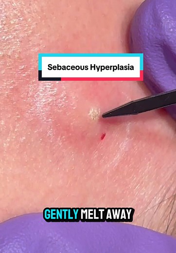 teresasong.md on TikTok