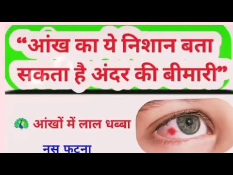 सामान्य ज्ञान प्रश्न/samanaya gyan gk #ssc#upsc#ias#ips#shorts#live#liestream 👉🔴