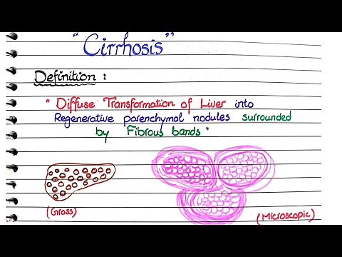 Cirrhosis of Liver | Pathology
