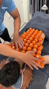 Cupping Therapy, Explained | FactSheetor