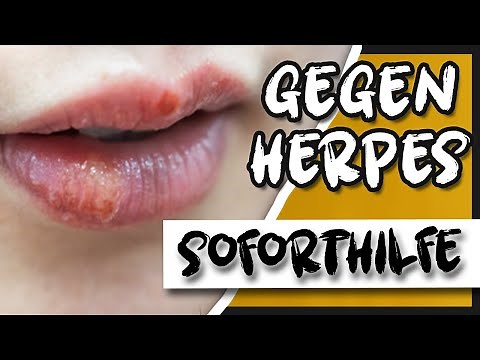 GEGEN FIEBERBLASEN (SOFORTEFFEKT) Hausmittel, Tipps und Tricks gegen Herpes HPV-1 | thajo torpedo