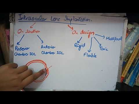 INTRAOCULAR LENS IMPLANT explained in simple way