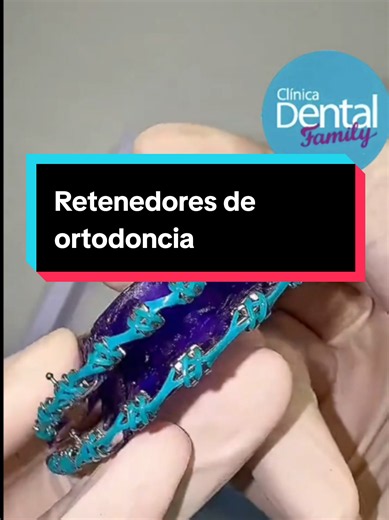 Retenedores de ortodoncia: modelos y uso después de brackets