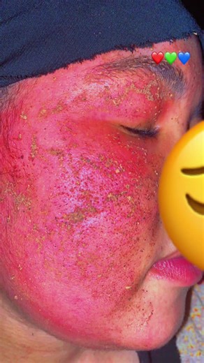 Yaaa rab waa ijeda xanun keygi adiga daremi karo 😢yarab manta jimco waye docdey iaqbal 🤲🏻alo xamunka iga dul qad manta igu ekey yaran🤲🏻😥🙏🏿😥😥