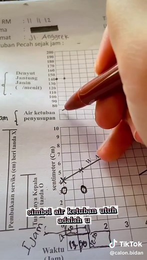 Cara Pengisian Partograf Part 3 yang Benar