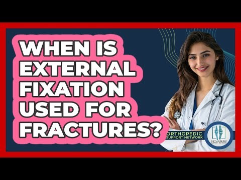 When Is External Fixation Used For Fractures? - Orthopedic Support Network