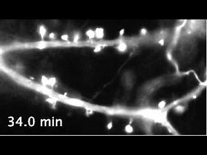 Dynamic actin filaments in dendritic spines