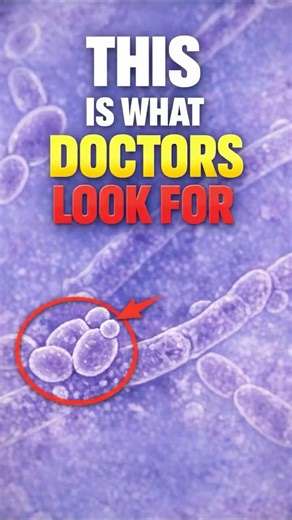 Real Vaginal Yeast Under the Microscope 🔬