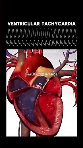 Understanding ECG changes | #anatomy #physiology #ecg #echo #science #neet