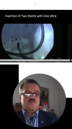 #gastroenterology #gastroenterologia #endoscopy #endoscopia #ercp | EndoCollab™ | Gastroenterology & Endoscopy Education