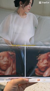 23K views · 748 reactions | Demo 1 chút 擄mún giấu kĩ chờ ngày tung mà Bên chụp gửi file gốc cho chọn ảnh mà cứ ngắm cái ảnh này nom cháu giống mẹ cháu chút chút nên hào hứng quá  #mebauvaembe #sohappy 懶 | Nhung Nguyễn | Facebook