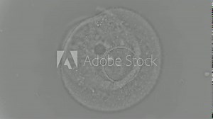 the movement of the cilia of the infusoria Trichodina, which is a parasite and is often sucked to fish and hydras, podzh by a microscope