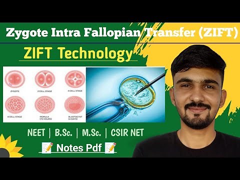 ZIFT Technology || Zygote Intra Fallopian Transfer || By Dadhich Sir