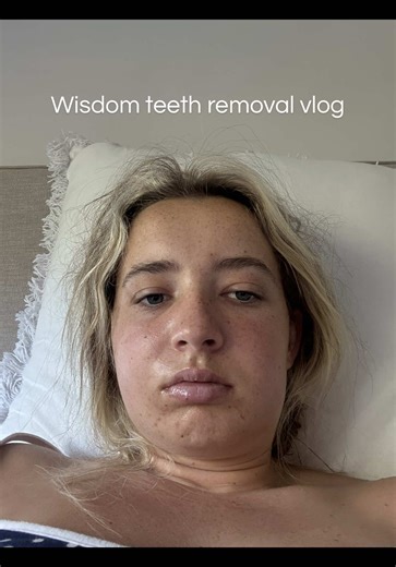 Wisdom teeth removal vlog ❌🦷 #surgery #wisdomteeth #fyp