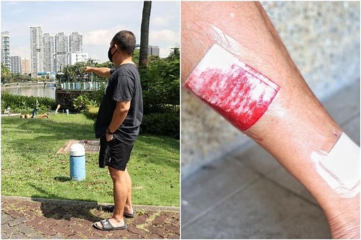 Man bitten by otter after trailing pack of 30 during morning run