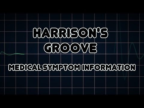 Harrison's groove (Medical Symptom)