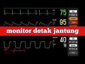 Suara Monitor Detak Jantung di Rumah Sakit