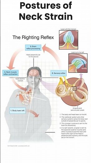 Why Chronic Neck Pain and Thoracic Outlet Syndrome Remains Chronic- The Righting Reflex Explained
