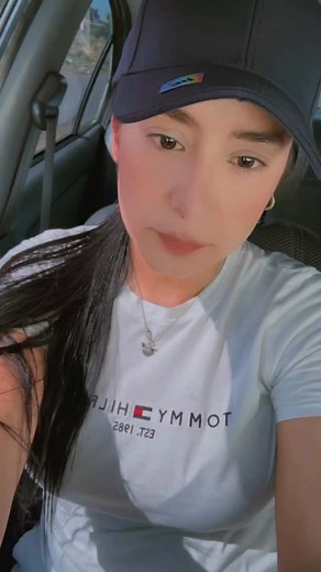 83K views · 53K reactions | Nada nos cuesta usar lar redes con un verdadero propósito: “SALVAR UNA VIDA” Y hoy le toca a este hermoso príncipe que todo los día llora de dolor de cabeza aunado a las convulsiones . Si deseas aportar tu granito dejaré en el primer comentario las únicas cuenta de la fundación   | Diana Rodriguez | Facebook