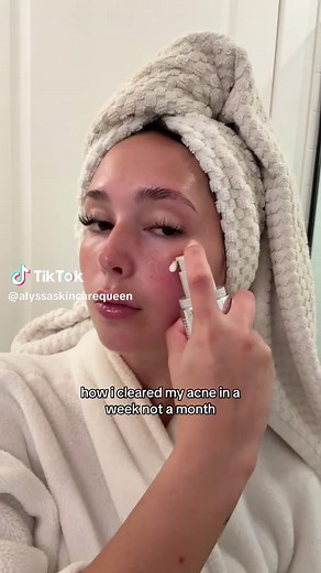 How I Cleared My Acne in a Week: My Skincare Secret
