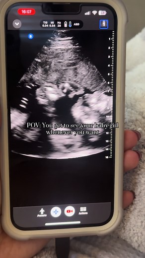 Exploring Pregnancy with a Mini Ultrasound Machine