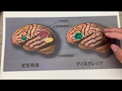 ディスレクシア (読字障害) の脳について