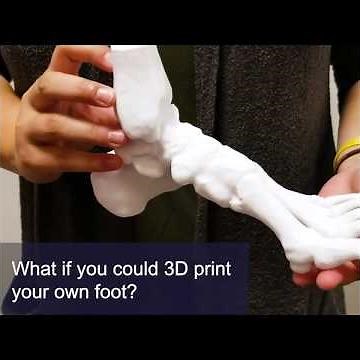 3D Printed Bones Give Patients a Look Inside Their Own Bodies