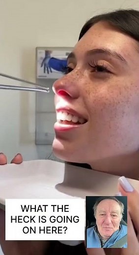 Doctor Extracts TWO ALIENS From Girl’s Nose — You Have to See This!