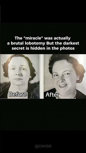 The Lobotomy Fraud: When Photos Lied