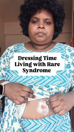 saranya sarath |chronic illness warrior on Instagram: "📍Dressing time. Living with Rare Syndrome . . . . . . . . . . . . . . . . . . . #fighter #emotional #journey #survivor #foryoupage #explore #explorepage #relatable #chronicillness #autoimmune #autoimmunewarrior #chronicpain #hidradenitissuppurativa #trending #instagram #trendingreels #reels"