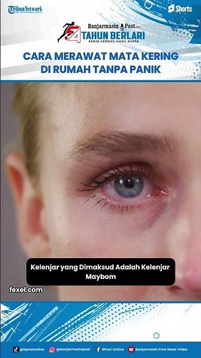 Cara Merawat Mata Kering di Rumah Tanpa Panik, Tips dari Dokter Mata