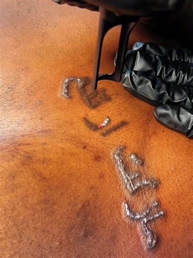 Chinese Script Sternum Tattoo Removal ✨🔥 | Laser Tattoo Removal in Nairobi Outgrown your tattoo? We help you start fresh at Rebel Inks Tattoos, Tattoo Removal, and Body Piercings Parlour Nairobi 💯 This session features a Chinese script sternum tattoo undergoing professional laser tattoo removal. The sternum area is delicate, which is why precision and controlled laser energy are key. Our advanced laser technology safely targets the dark ink, breaking it into tiny particles so your body can nat