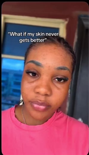 Recommendations ??? I’ve Got You Covered🩵✨🧴#cosmeticschallenge #fyp #trendingvideo #skincare #beautiful @UCHECHUKWU✨🌸