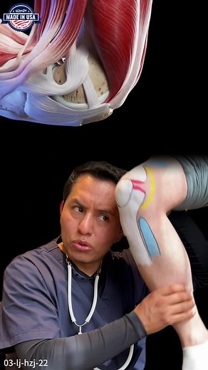 Understanding Bone Spurs and Knee Pain Relief