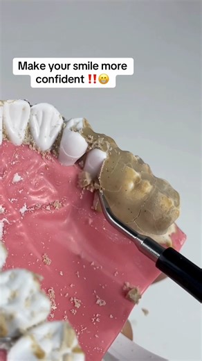 ViralGadgets Studio on Instagram: "Link in Bio ✨ Effortlessly remove dental calculus at home and keep your smile fresh! 🦷✨ #GoodStuff #GoodThings #HomeHacks #Useful #HealthyLiving""