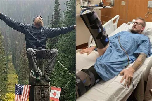 Hiker's 'Little Burn' from Camping Skillet Leads to Double Amputation — but He Vows to Get Back on the Trail