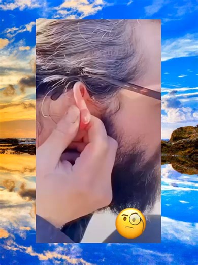 Satisfying Pimple Popping Compilation