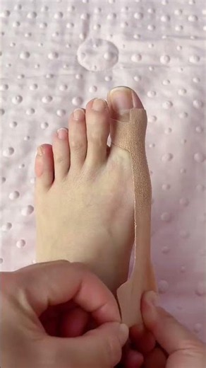 🦶 Bunion Correction Taping Tutorial ✨ Easy Overlapping Toes Relief & Foot Support Tips 👣