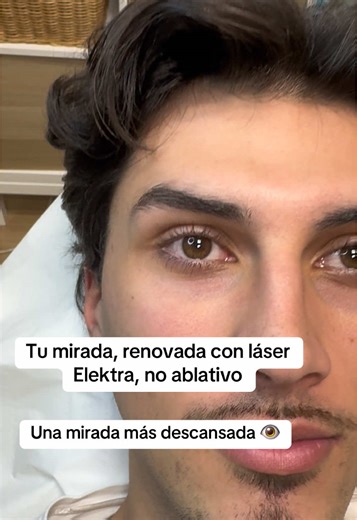 ¿Mirada cansada aunque hayas descansado? Las ojeras pueden hacer que tu rostro se vea apagado. Con el láser no ablativo Elektra mejoramos la calidad de la piel del contorno ocular, estimulando el colágeno y aportando un aspecto más fresco y descansado, sin cirugía y con mínima recuperación. Resultados naturales. Tecnología segura. Tu mirada, más luminosa. ¿Quieres saber si es para ti? Escríbenos por DM y solicita tu valoración personalizada. 📲 658 52 13 68 #Ojeras #MiradaDescansada #LáserNoAbla