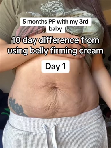 Targeted belly care you can add to your daily routine Firming Cream is designed to help the skin on your midsection look smoother, firmer, and more toned V Helps improve the look of skin elasticity V Supports a smoother, more even appearance V Hydrating, fast-absorbing, non-greasy V Perfect for postpartum, weight-loss journeys, or everyday self-care Just massage it into your belly daily and let it become part of your simple body-care routine. Consistency is key—and this one feels luxe without th