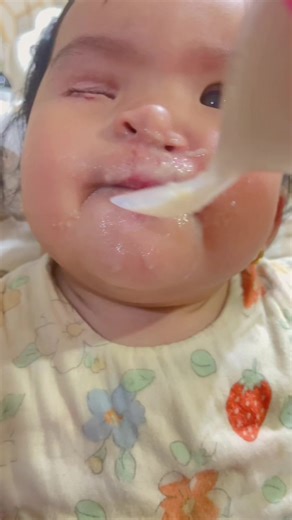 Feeding a Cleft Baby: A Special Moment