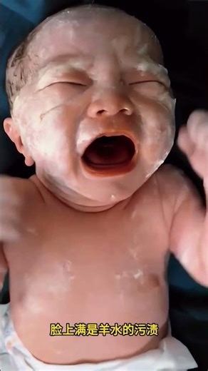 The newborn baby started crying loudly.