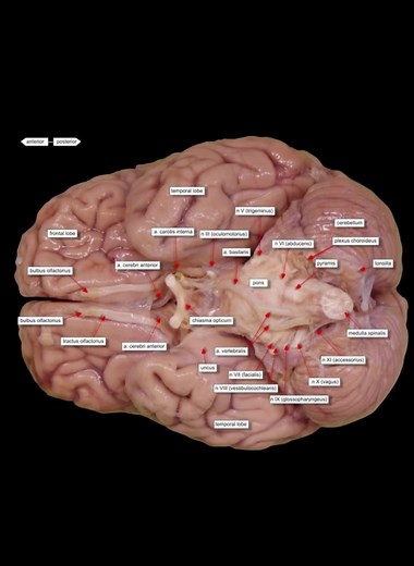 #targetaudience #anatomy #brain #creatorsearchinsight | brain