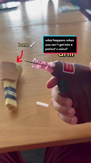 Understanding Intraosseous Drill for Medical Procedures