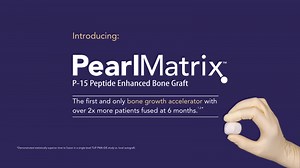 PearlMatrix bone graft. The first and only bone growth accelerator designed to accelerate lumbar fusion. | Cerapedics Inc.